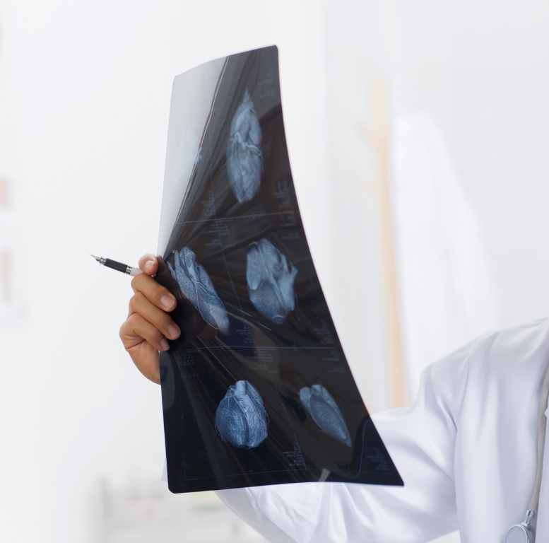 Imaging VIS-X-Ray Cameras, Thermography Camera